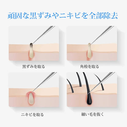 【0.1mm超微細先端、1秒で深層の黒ずみを除去】東京美容院同款プロ用黒ずみ・にきびピンセット✨毛穴の詰まりを取り除き、白く透き通った肌を手に入れましょう